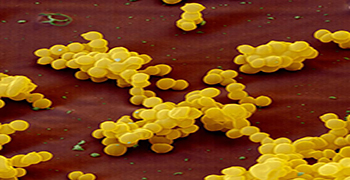 细菌毒素你知道多少？